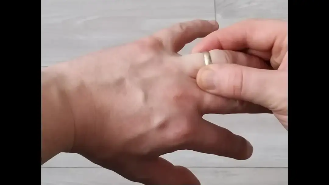 Jak zdjąć obrączkę: 5 skutecznych sposobów na ciasny pierścionek