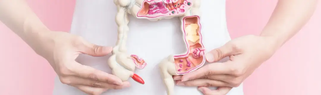 Rak jelita grubego przyczyny: poznaj czynniki ryzyka i ich wpływ