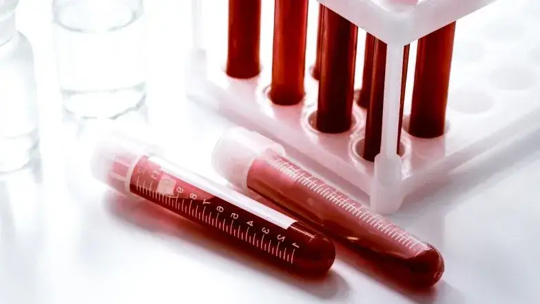 Podwyższony poziom erytrocytów: najważniejsze przyczyny i objawy choroby