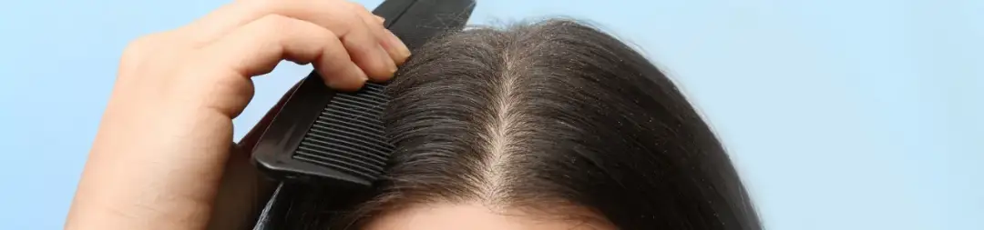 Jak nakładać peeling na skórę głowy, by uniknąć podrażnień i zyskać zdrowe włosy