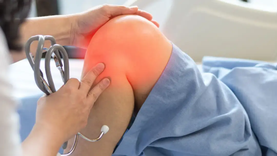 Kiedy rehabilitacja po endoprotezie kolana? Kluczowe informacje i porady