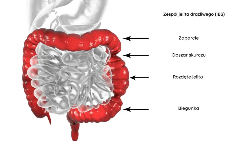 Zespół jelita drażliwego: jakie badania są kluczowe dla diagnozy?