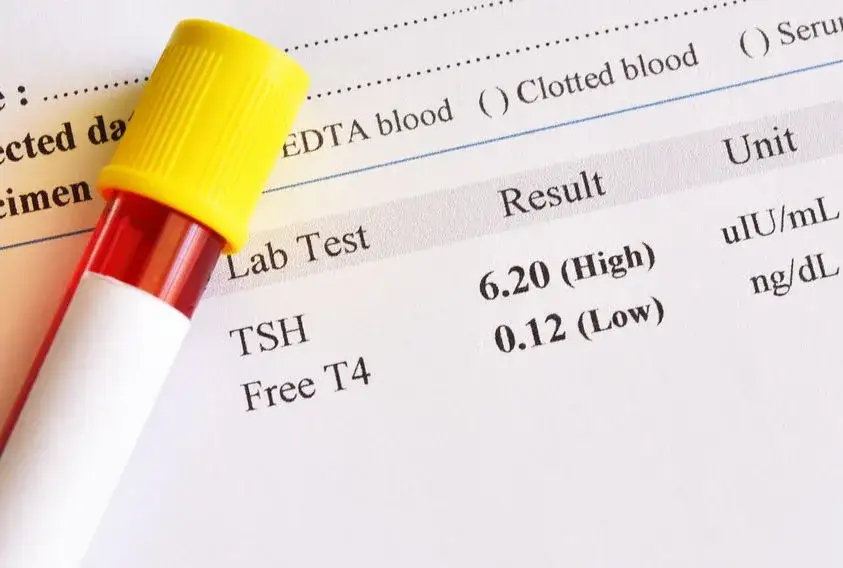 FT4 co to za badanie i jakie ma znaczenie dla twojego zdrowia?