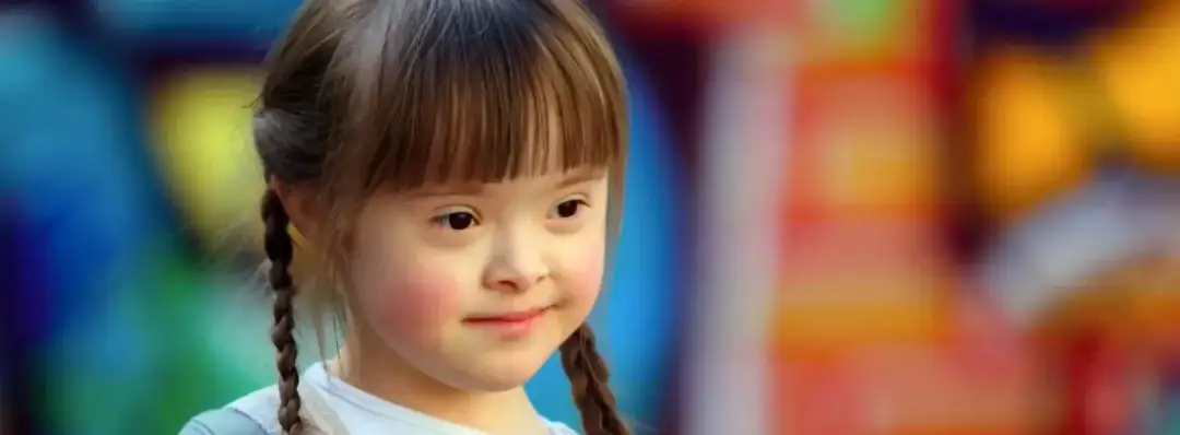 Czy zespół Downa można wyleczyć? Prawda o tej genetycznej chorobie