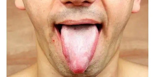 Grzybica ogólnoustrojowa - diagnostyka groźnej infekcji