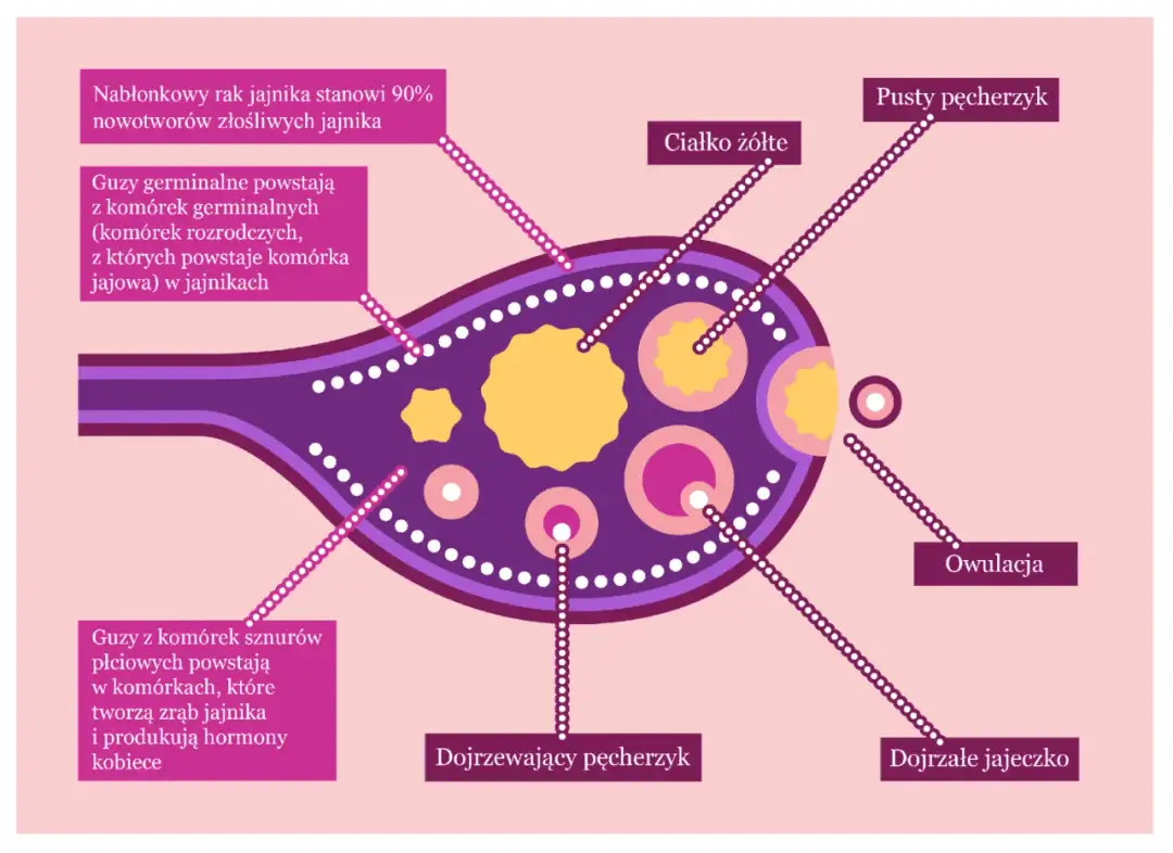 Rak narządów rodnych objawy – niebagatelne sygnały, które mogą zaskoczyć