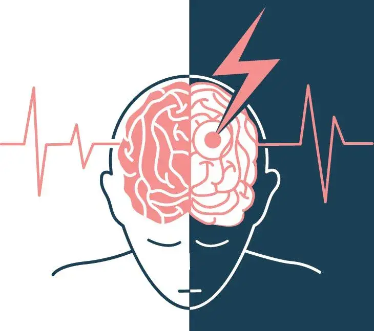 Udar: objawy, które musisz znać, i pierwsza pomoc, która ratuje życie