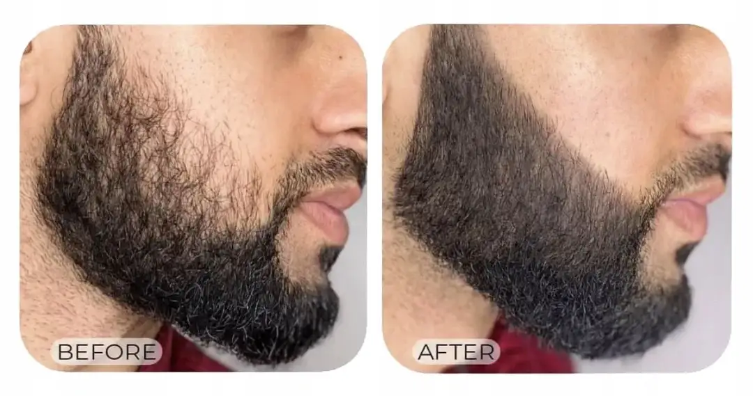 Konturowanie brody? Oto 5 trików na idealny kształt ostry jak brzytwa