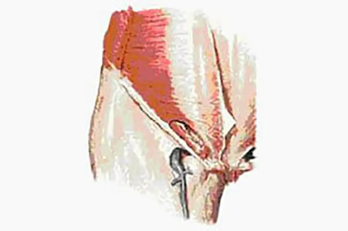 Illustration anatomique montrant la région du périnée masculin, utile pour comprendre l'inflammation périnée homme traitement.
