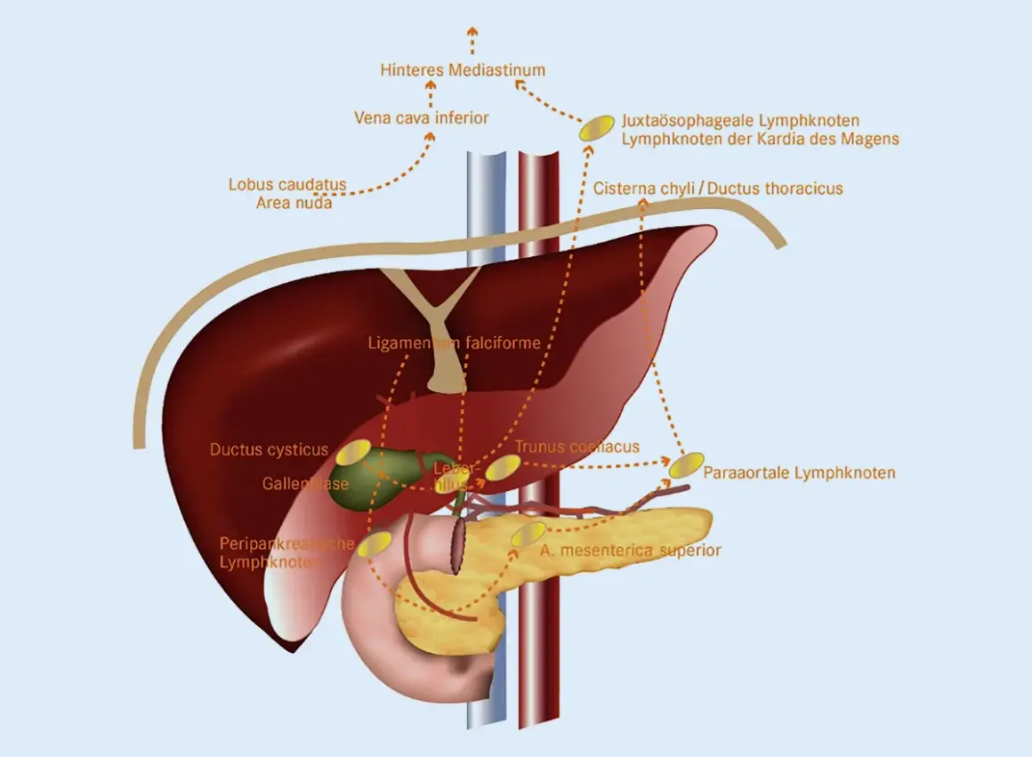 Anatomische Darstellung des Lymphknotenbesatzes im Bereich von Leber, Gallenblase und Bauchspeicheldrüse. Dargestellt sind verschiedene Lymphknotengruppen.