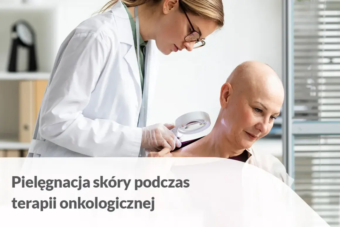 Lekarka bada skórę pacjentki zmagającej się z chorobą nowotworową. Dbałość o skórę podczas radioterapii jest kluczowa.