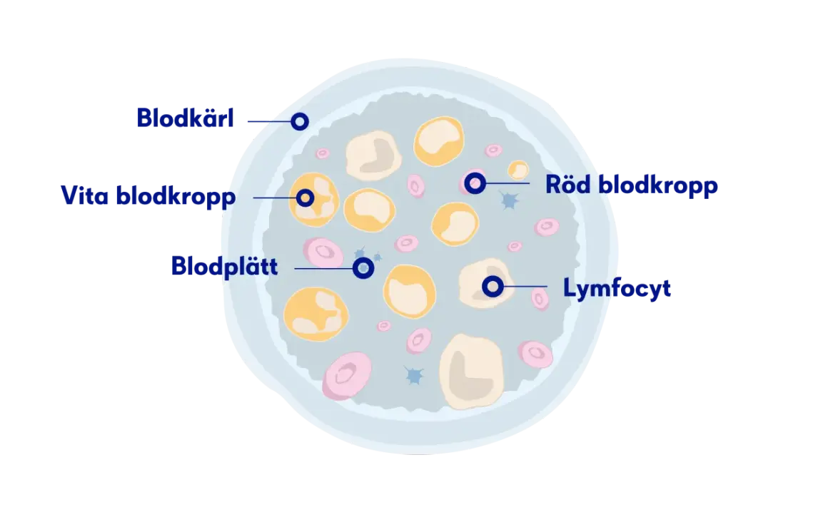 Illustration av blodkroppar, blodplättar och lymfocyter. Låga nivåer av röda blodkroppar kan vara ett av anemi symtom.