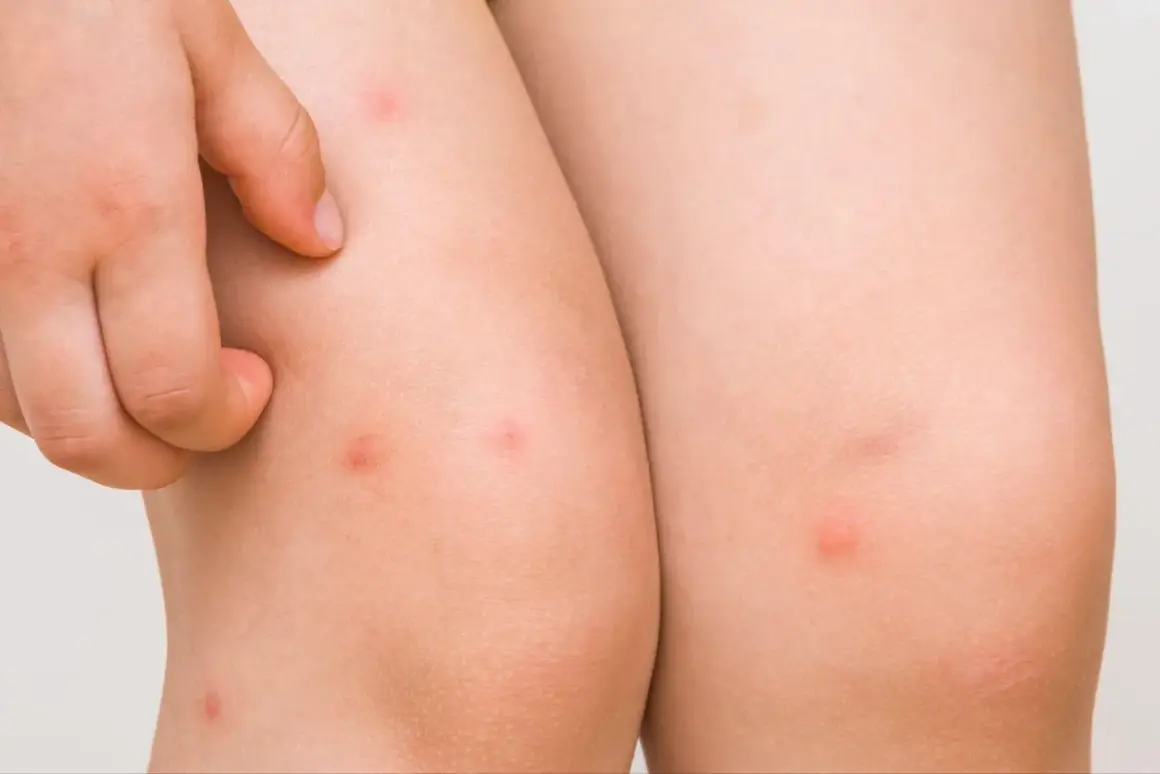 Un niño se rasca las piernas, mostrando pequeños granos rojos que parecen ser causados por el sudor.