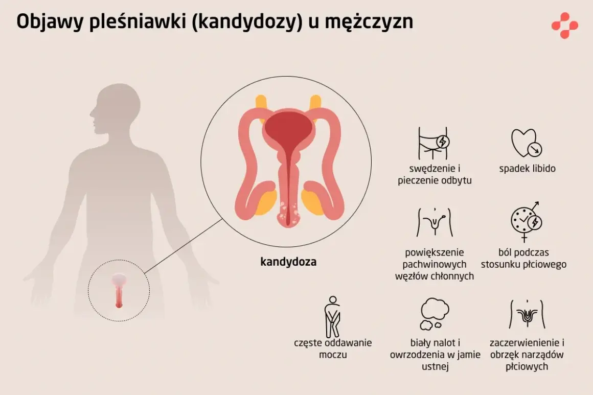Objawy kandydozy u mężczyzn: pieczenie, spadek libido, ból podczas stosunku, zaczerwienienie narządów płciowych.