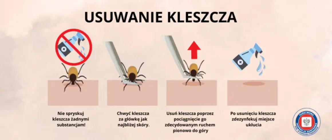 Jak bezpiecznie usunąć kleszcza? Sprawdzony poradnik krok po kroku