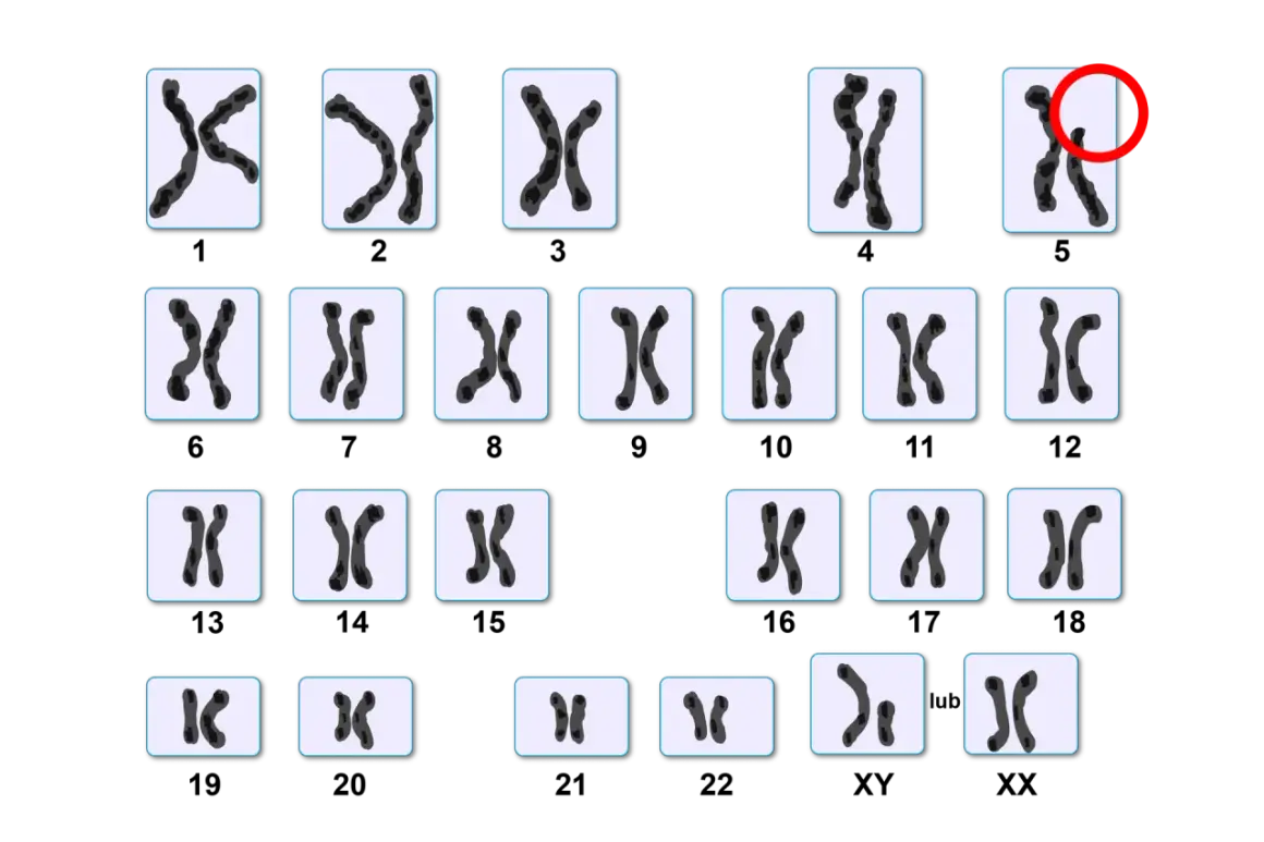 Kariotyp człowieka: 22 pary autosomów i jedna para chromosomów płci (XX lub XY). Ile człowiek ma chromosomów? 46.
