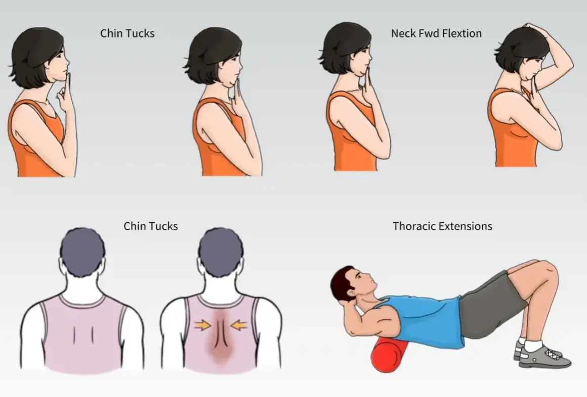 Esercizi per correggere la sindrome della testa in avanti: chin tucks, flessione del collo e estensioni toraciche con rullo.