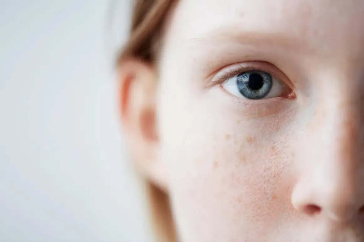 Nahaufnahme eines blauen Auges und der Wange einer Person mit Sommersprossen. Sanfte Pflege für empfindliche Haut ist hier sichtbar.