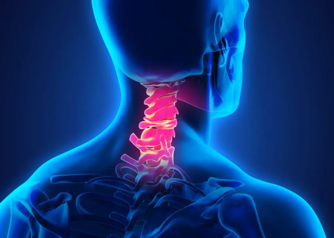 Colonna vertebrale cervicale illuminata in rosso, suggerendo cervicalgia e vertigini.
