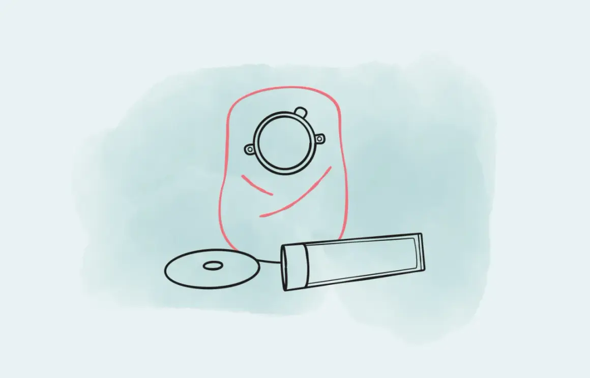 Stomaversorgung: Beutel, Hautschutzplatte und Paste. Ein stoma voll ist kein Problem mit der richtigen Ausrüstung.