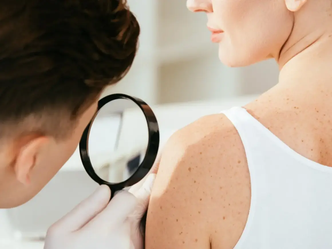 Dermatologia co to? Lekarz ogląda pieprzyki na ramieniu pacjentki przez lupę.