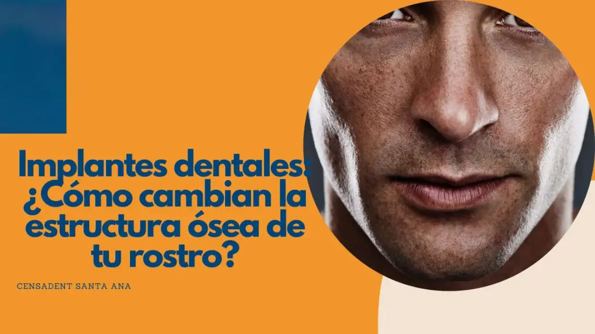 Primer plano de un rostro masculino con texto que pregunta cómo los implantes dentales cambian la estructura ósea.