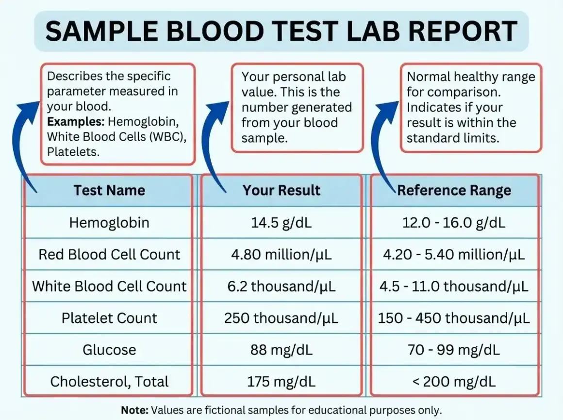 Przykładowy raport z badania krwi, pokazujący wyniki dla hemoglobiny, liczby czerwonych krwinek, białych krwinek, płytek krwi, glukozy i cholesterolu, wraz z normami. CEA.