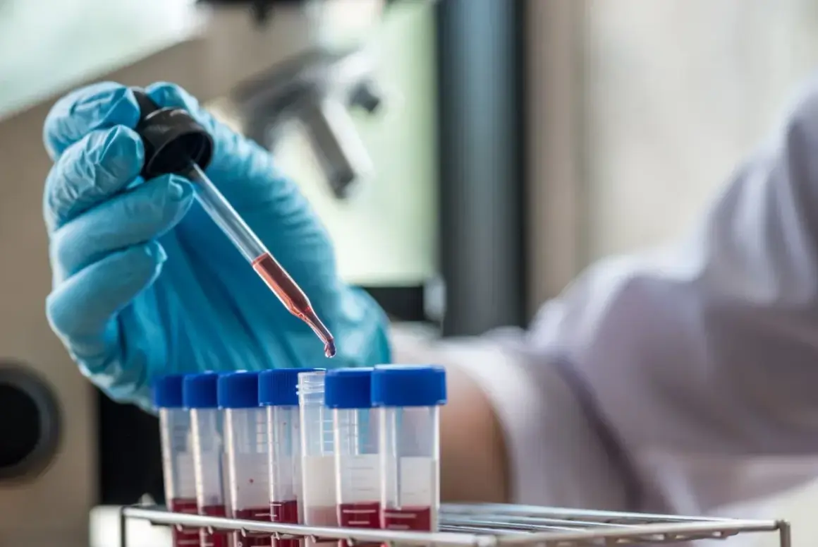 Ręka w niebieskiej rękawiczce pobiera próbkę krwi do analizy. Badanie HIV cena jest kluczowa dla szybkiej diagnostyki.