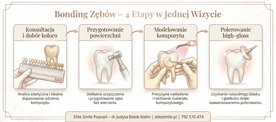Bonding zębów: konsultacja, przygotowanie, modelowanie kompozytu i polerowanie. Zabieg nie niszczy zębów, a jedynie je upiększa.