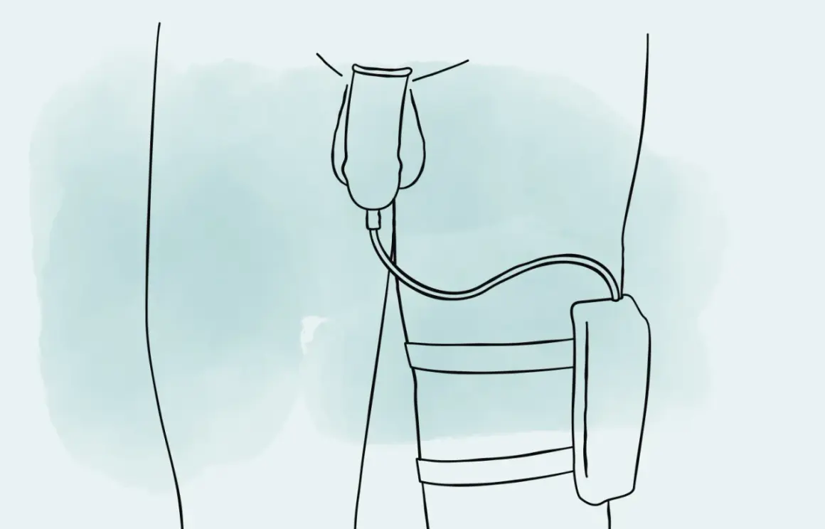 Illustration zeigt, wie man ein Urinalkondom anlegt. Ein Schlauch verbindet das Kondom mit einem Auffangbeutel am Bein.