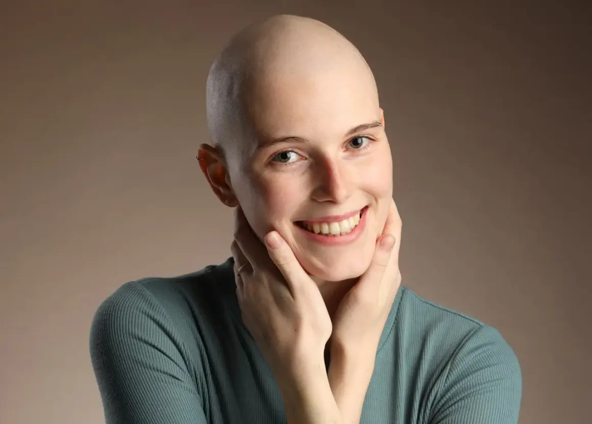 Lächelnde Frau mit Glatze, die ihre Wangen berührt. Ihre positiven Lymphom Chemotherapie Erfahrungen strahlen aus ihr.