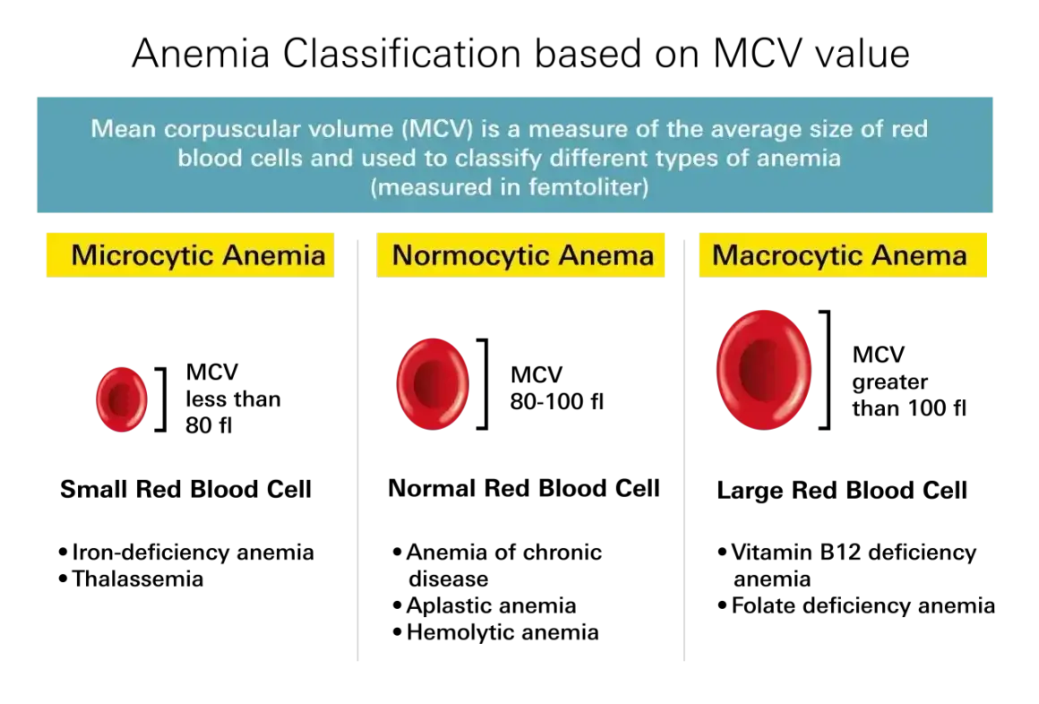 Porównanie wielkości krwinek czerwonych w mikrocytozie, normocytozie i makrocytozie. Badania na anemię oceniają te parametry.