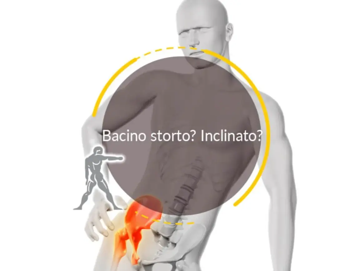 Un bacino ruotato o inclinato può causare dolore. L'osteopata può aiutarti a riallinearlo.