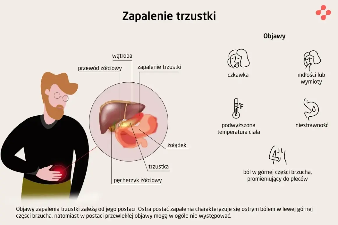 Ilustracja przedstawia objawy zapalenia trzustki: ból brzucha, nudności, gorączkę i niestrawność.