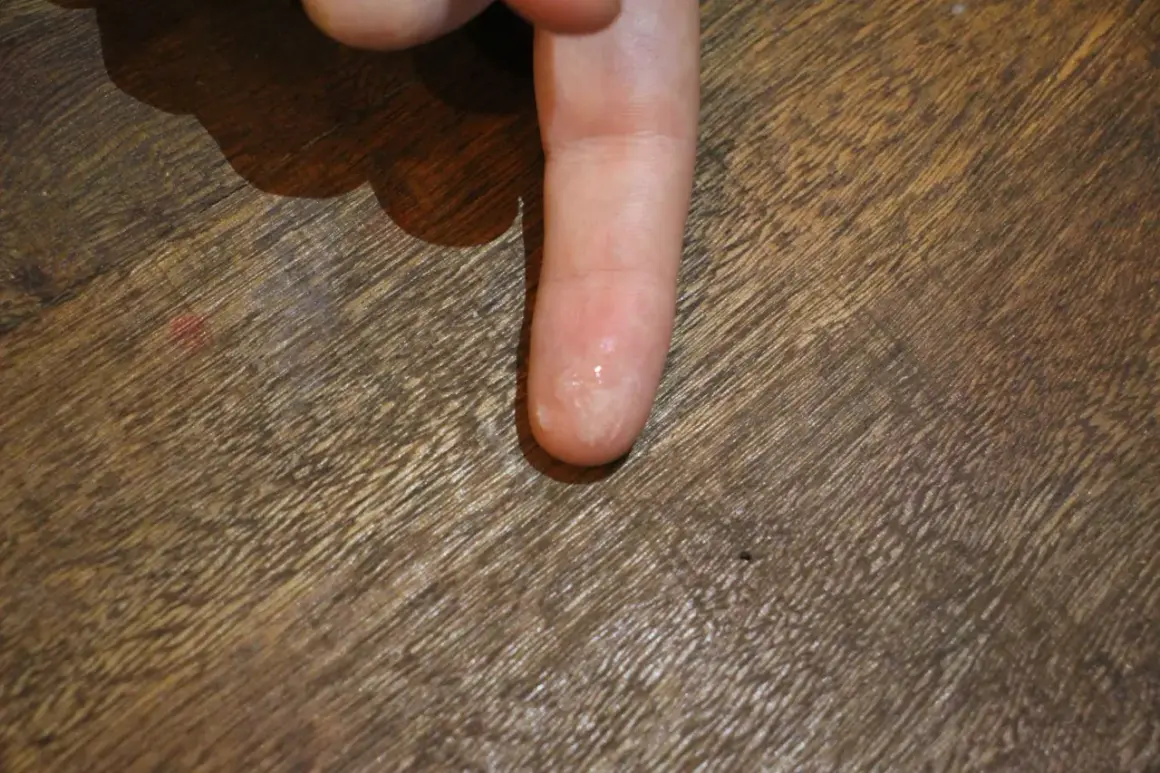 Doigt collé par de la glue. Voici comment enlever de la colle glue sur les doigts : tremper dans de l'eau savonneuse ou utiliser de l'huile.