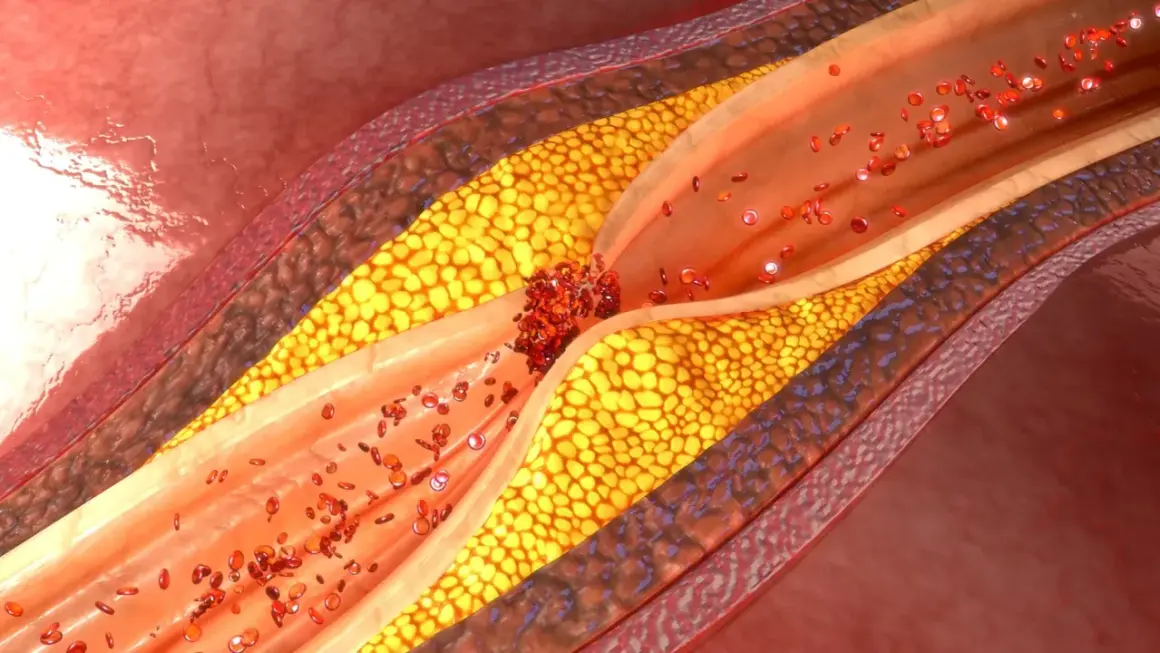 Cholesterol: Leki, działanie, skutki uboczne. Rozwiewamy mity!