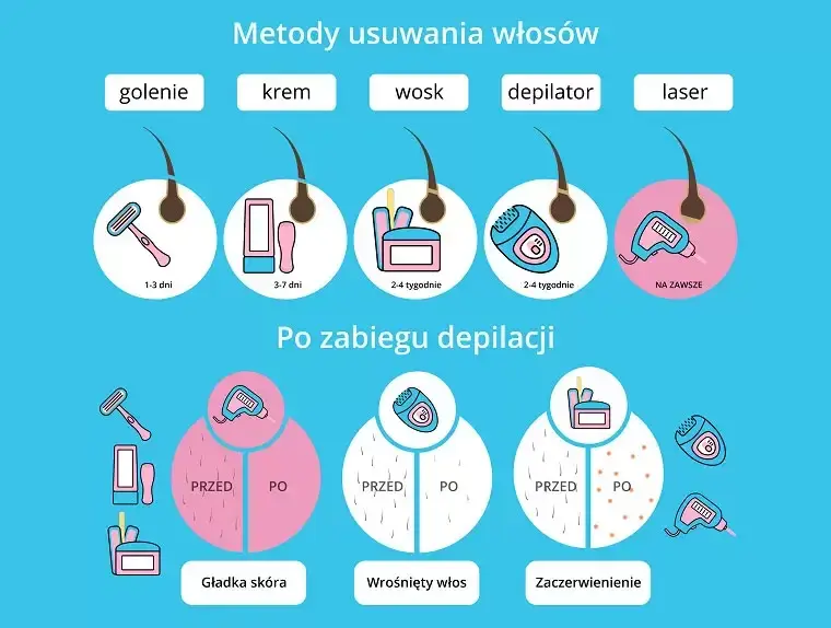 Depilacja laserowa co ile tygodni? Odkryj sekret skuteczności!