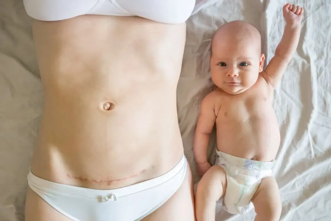 Pierwszy spacer po cesarce. Mama z widoczną blizną na brzuchu i noworodek z podniesioną rączką leżą obok siebie.