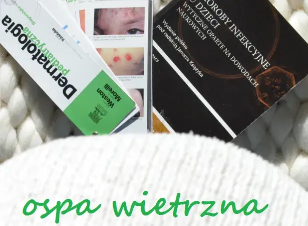 Czy rodzeństwo dziecka z ospą może chodzić do przedszkola bez ryzyka?