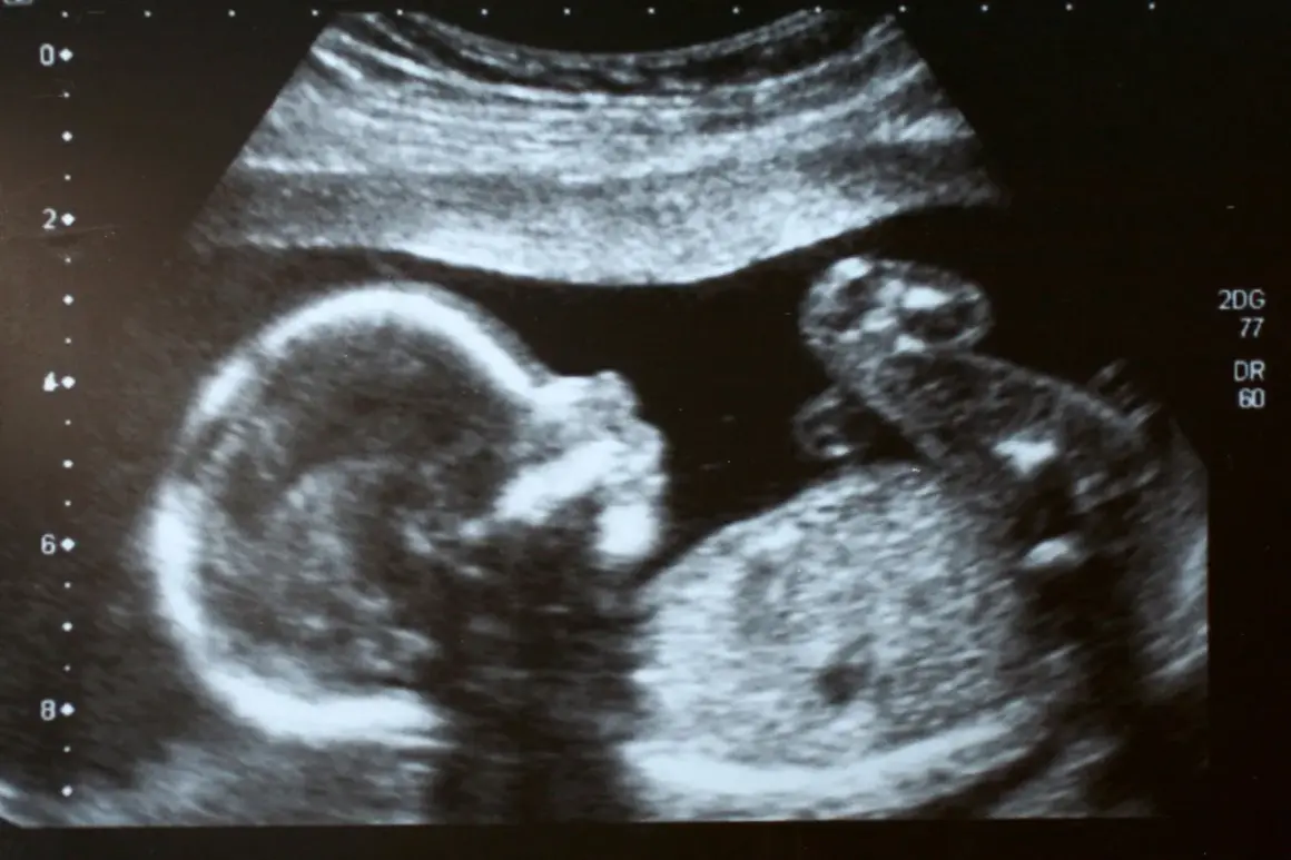 Ultraschallbild eines Babys. Die detaillierte Aufnahme zeigt das Gesicht und den Körper des Kindes, was beim Ultraschall zur Geschlechtsbestimmung hilfreich ist.