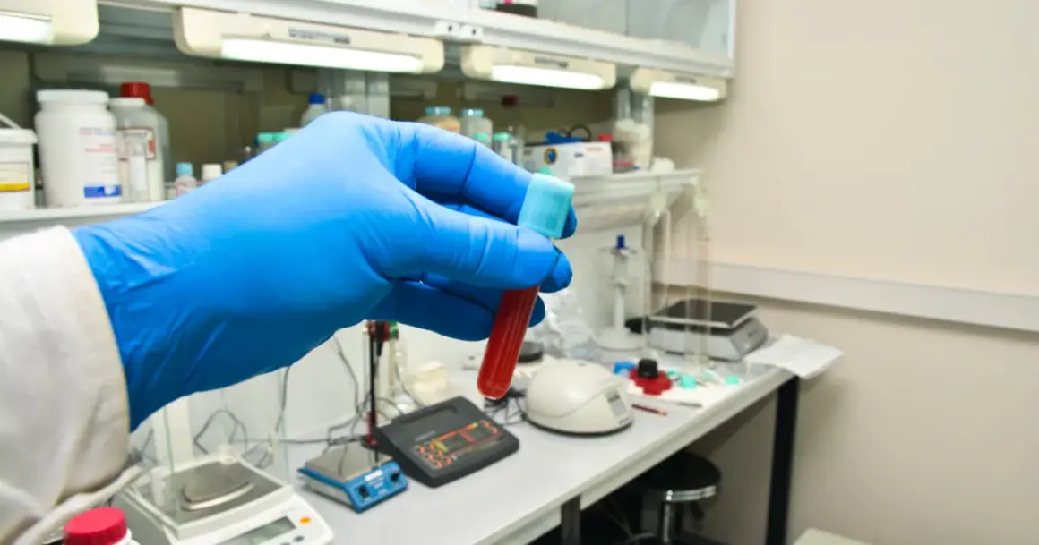Ręka w niebieskiej rękawiczce trzyma probówkę z krwią. W tle laboratorium, gdzie badane są bazofile podwyższone u dziecka.
