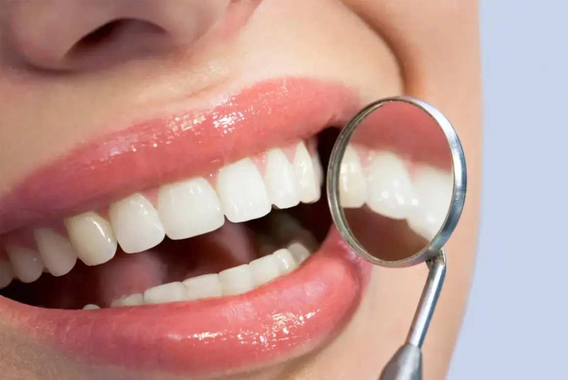 Uśmiech z lśniącymi zębami, badany lusterkiem dentystycznym. Zdrowe dziąsła to podstawa, by uniknąć problemów jak szkorbut.