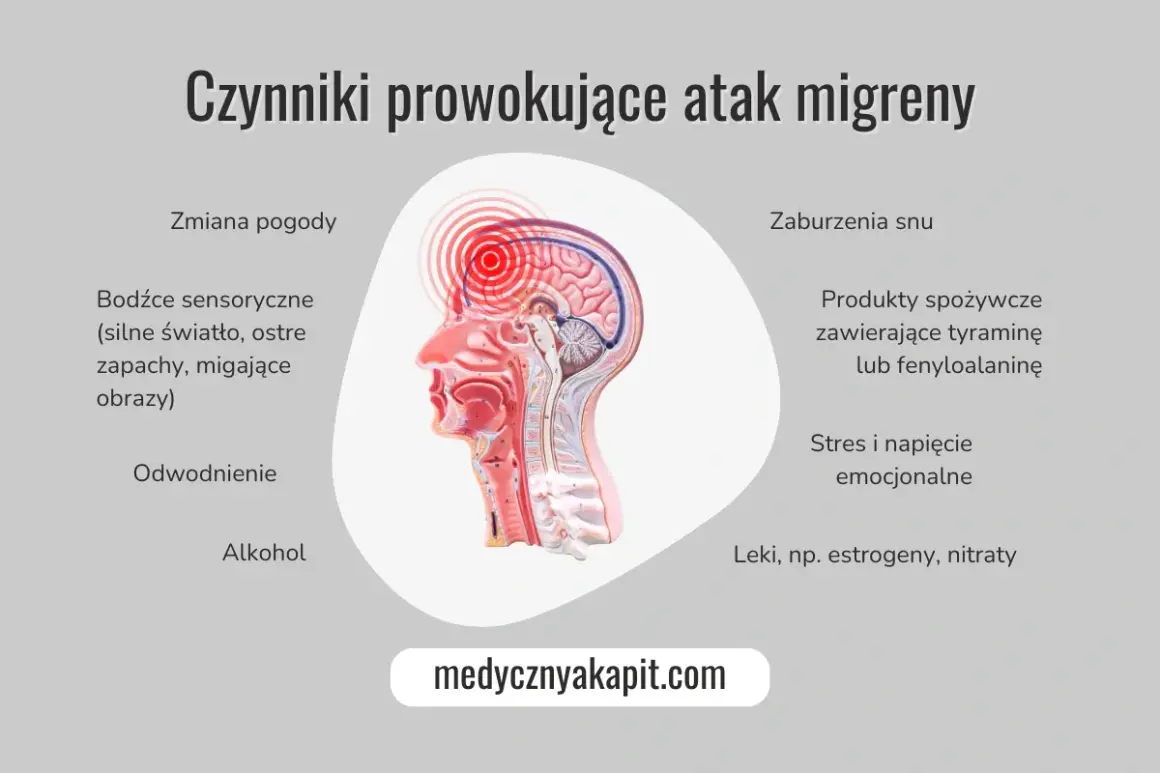 Grafika pokazuje czynniki wywołujące migrenę: zmiany pogody, bodźce sensoryczne, odwodnienie, alkohol, zaburzenia snu, produkty spożywcze, stres i leki. Poznaj sposoby, jak radzić sobie z migreną.