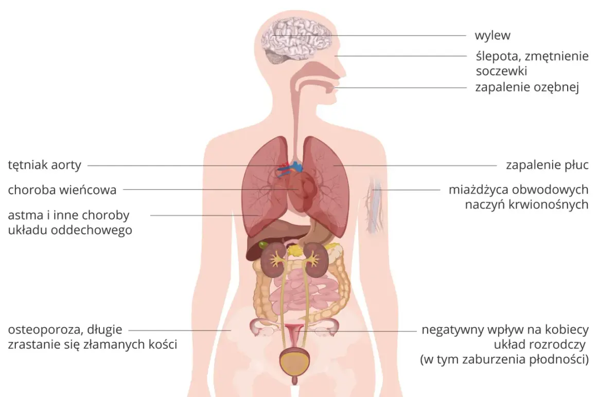 Schemat ciała ludzkiego z zaznaczonymi chorobami, w tym astma i inne choroby układu oddechowego.