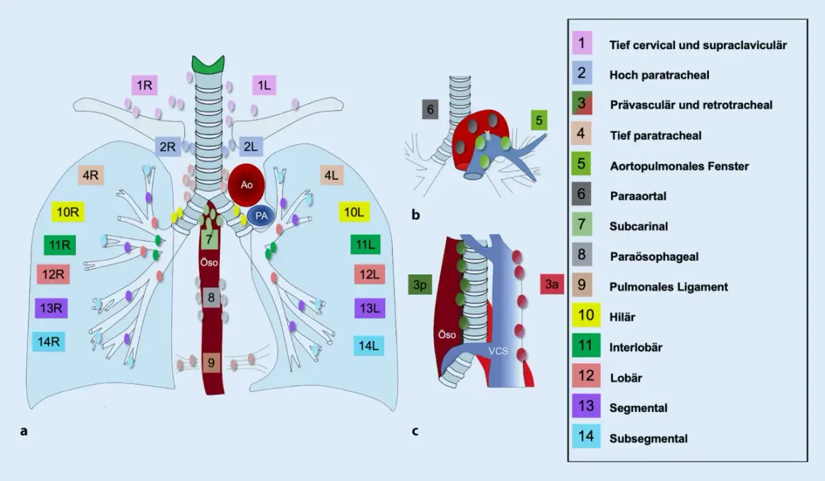 Schema der Lymphknotenstationen im Thorax. Station 10 zeigt die **hilus lymphknoten** im Lungenhilus.