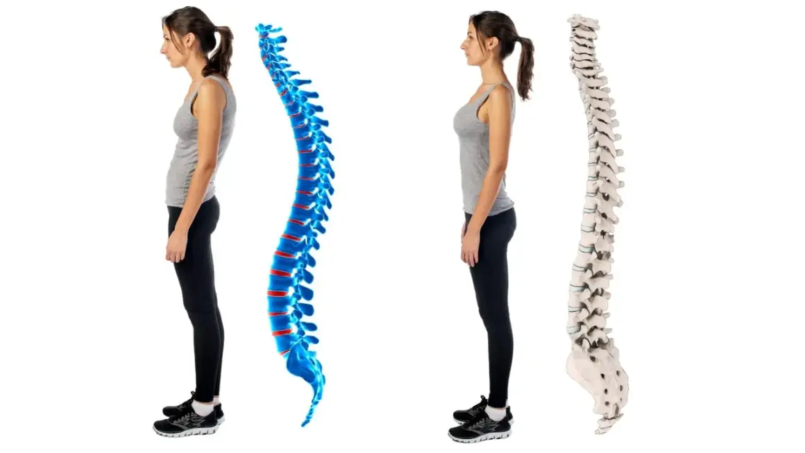 Postura scorretta e dolori addominali: confronto tra colonna vertebrale curva e dritta.