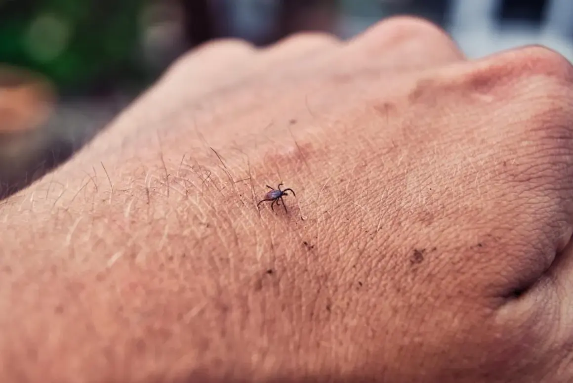Kleszcz na skórze. Zastanawiasz się, po jakim czasie od ukąszenia kleszcza zrobić badanie na boreliozę?