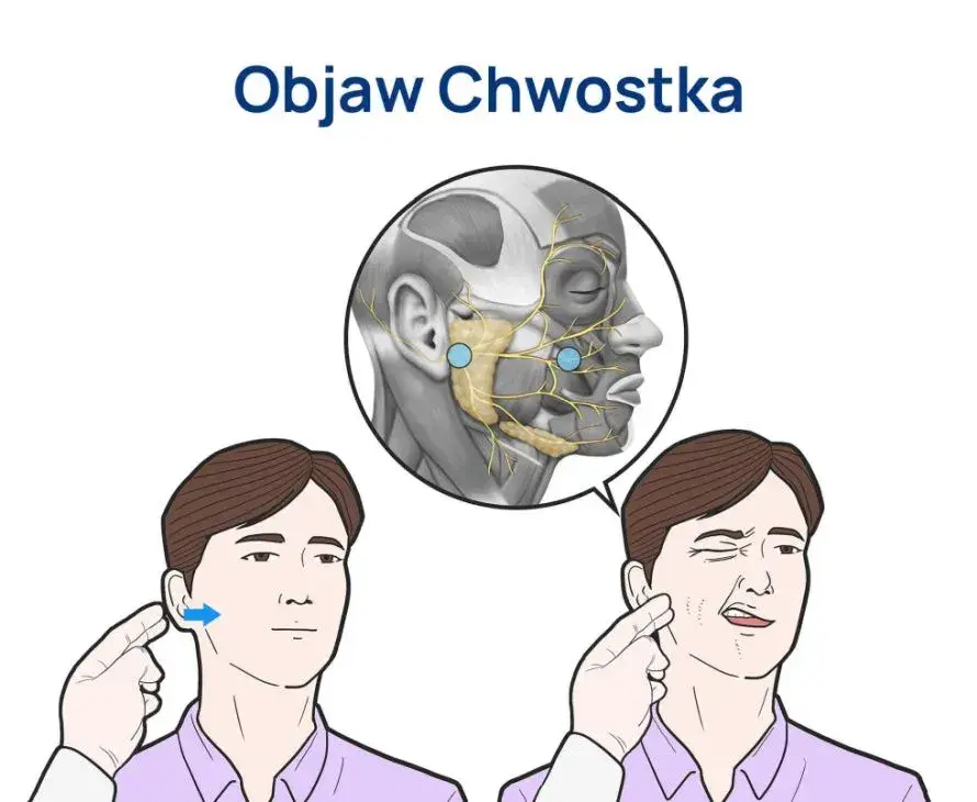 Tężyczka a nerwica: objawy psychiczne, diagnoza i leczenie