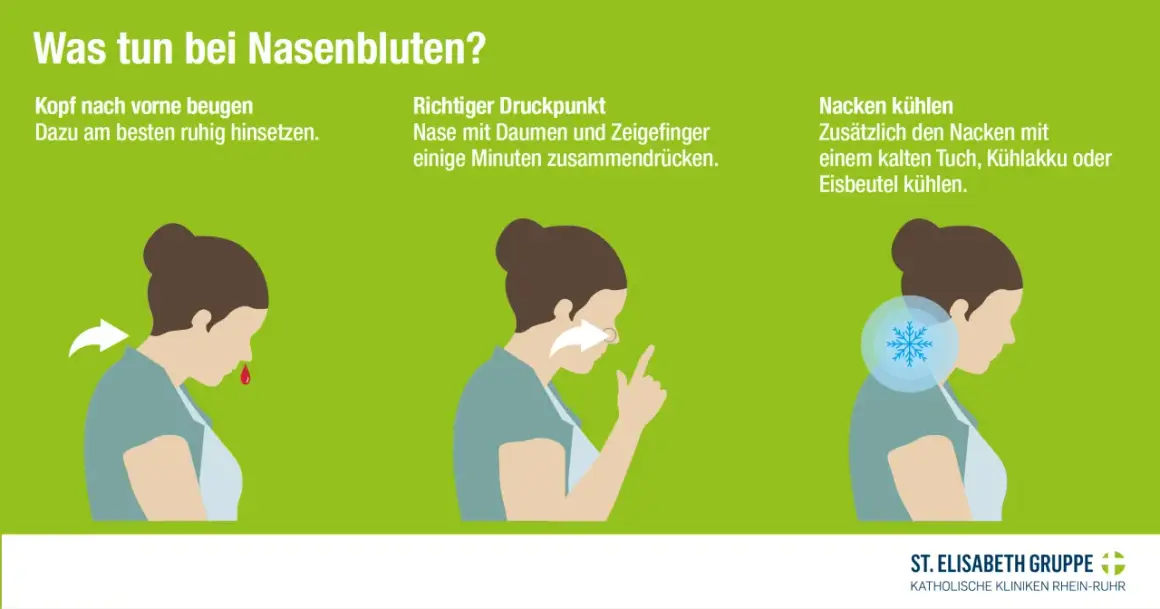 Bei Nasenbluten: Kopf vor, Nase drücken. Nacken kühlen mit einem kalten Lappen.