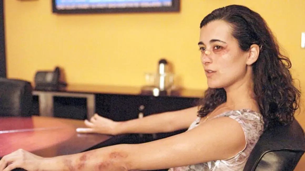 Cote de Pablo mit blauen Flecken im Gesicht und am Arm, sitzt nachdenklich in einem Stuhl.